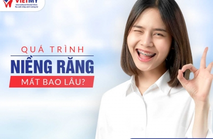 Niềng răng mắc cài